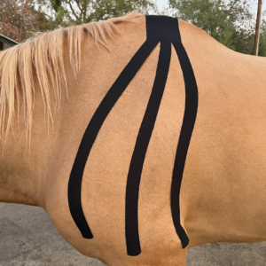 Kinesiology Taping_ calypso therapeutics